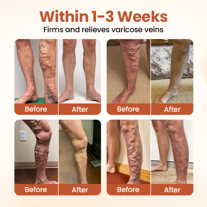 Timilk® VeinTarget Microneedle Patch.