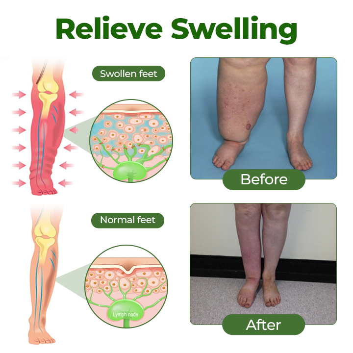 Timilk®Professional Leg Circulation Cream.