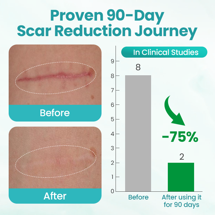 Timilk® EliteAloe ScarSolve Spray.