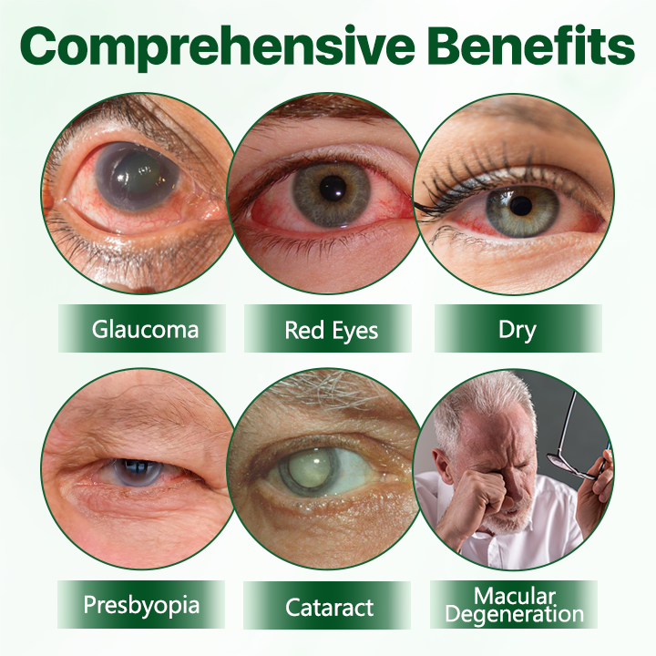 Biancat® Vision Enhancing Multifunctional Eye Drops.