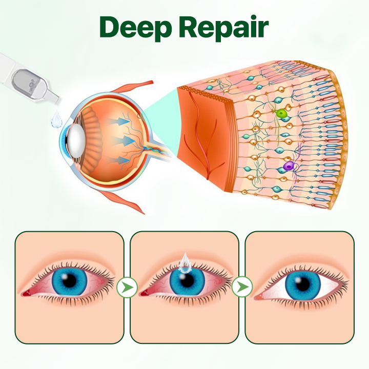 Biancat® Vision Enhancing Multifunctional Eye Drops.