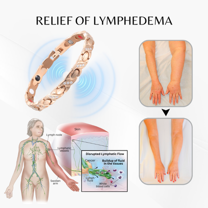 Czticle® MagnaCalm Copper Magnet Wellness Bracelet