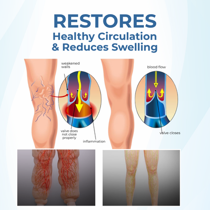 Timilk® TheraVein Varicose Herbal Spray