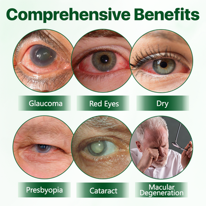 Biancat® Vision Enhancing Multifunctional Eye Drops.