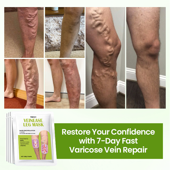 Timilk®VeinEase Leg Mask.