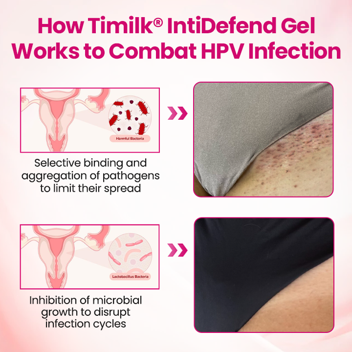 Timilk® IntiDefend Anti-HPV Interferon Gel.