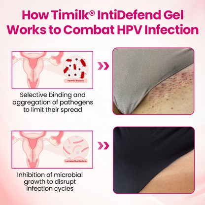 Timilk® IntiDefend Anti-HPV Interferon Gel.