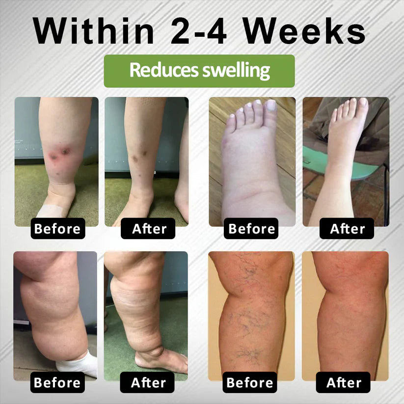 Timilk®Professional Leg Circulation Cream