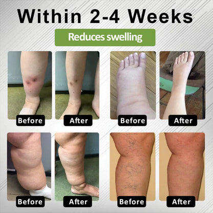 Timilk®Professional Leg Circulation Cream