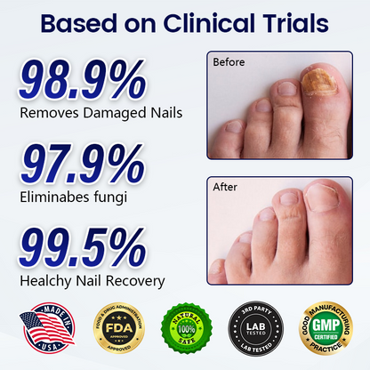 Timilk® Anti-Fungal Nail Repair Patch
