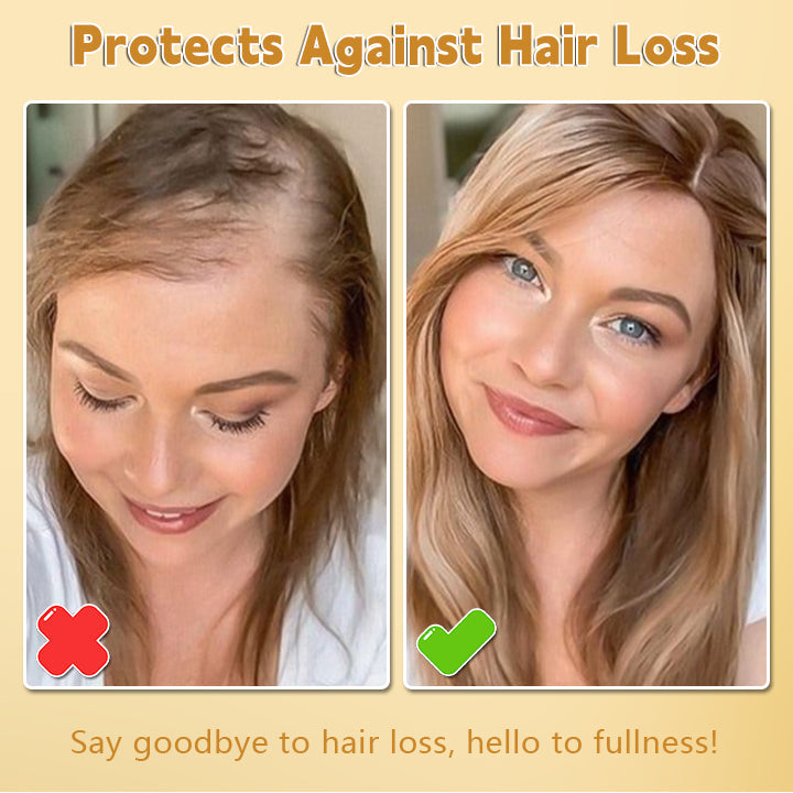 Biancat™ Biotin Hair Growth Essence Spray (New Formula)