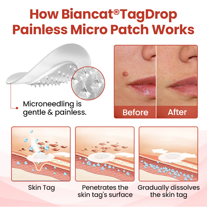 Biancat® TagDrop Painless Micro Patch.