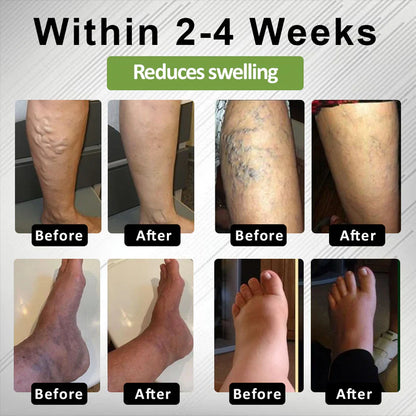 Timilk®Professional Leg Circulation Cream