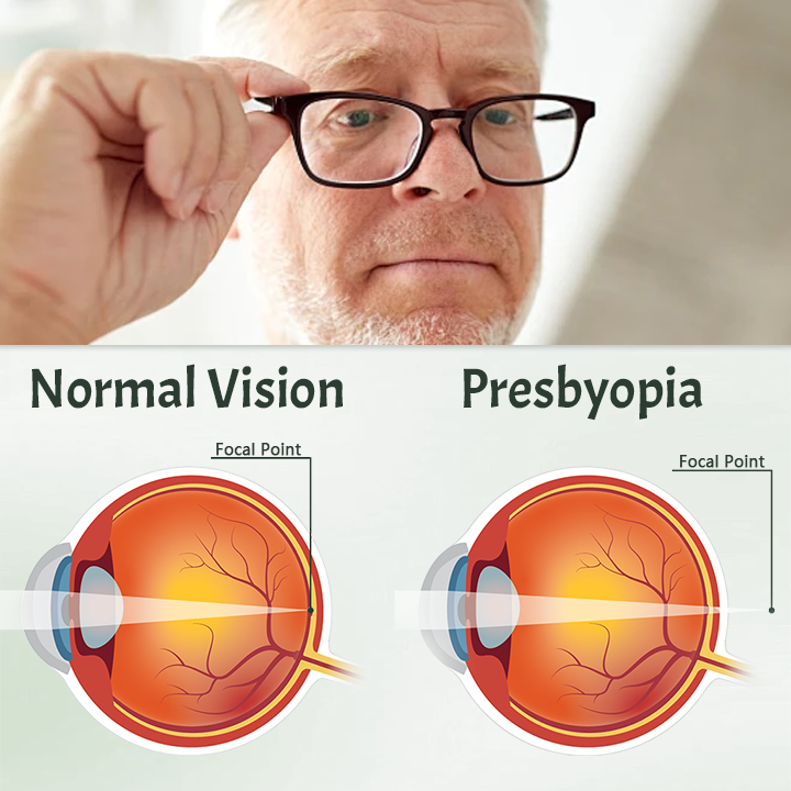 Ceoerty® Myopia Reversal Eye Drop.