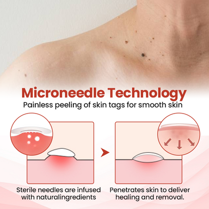 Biancat® TagDrop Painless Micro Patch.