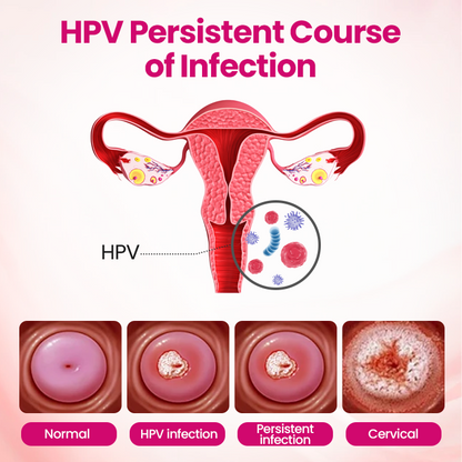 Timilk® IntiDefend Anti-HPV Interferon Gel.