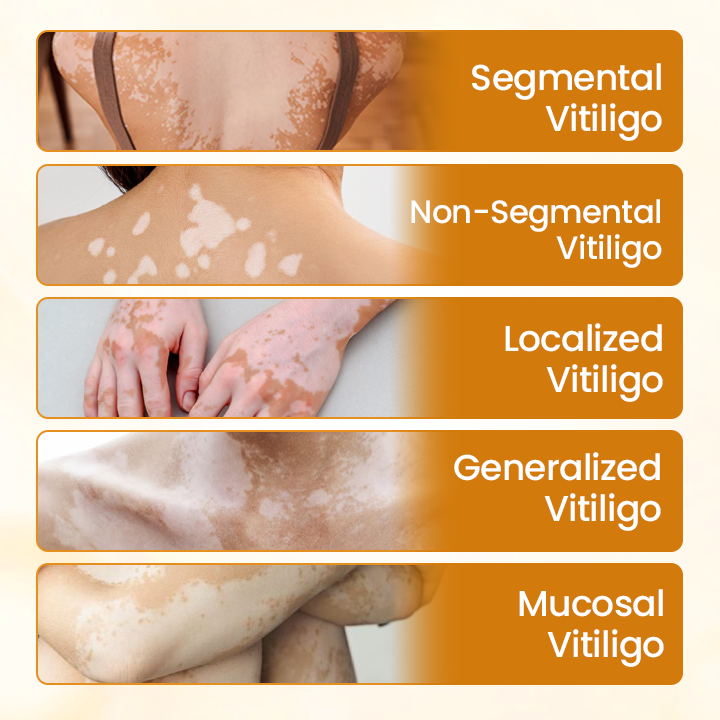 Timilk® VitiCalm Bee Venom Cream.