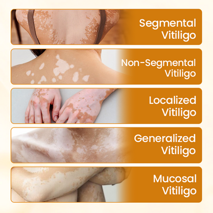 Timilk® VitiCalm Bee Venom Cream.