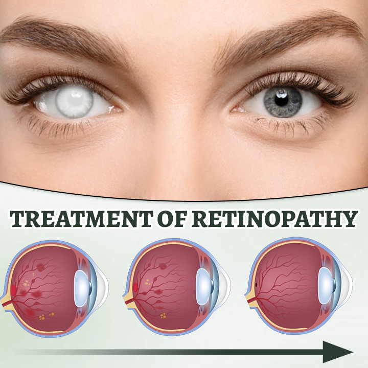 Ceoerty® Myopia Reversal Eye Drop.