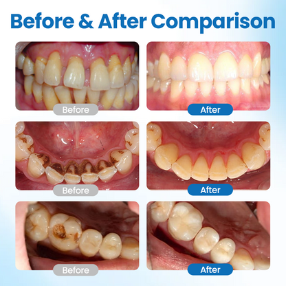 Biancat® NanoHAP Tooth Defense Serum