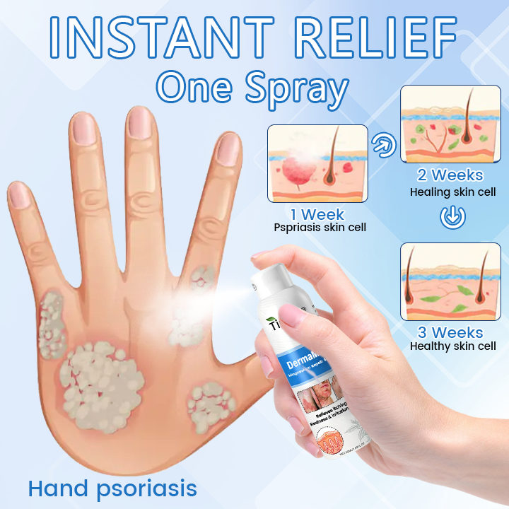 ✅ Official Store: Timilk® DermaMag Magnesium Repair Spray 🔥 FDA Certified (Clinically Proven Relief for Psoriasis, Eczema, and Chronic Skin Irritation 🌿)