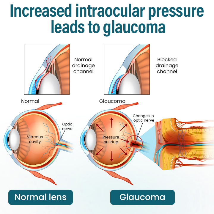 Timilk® OptiRegen Nano Eye Serum