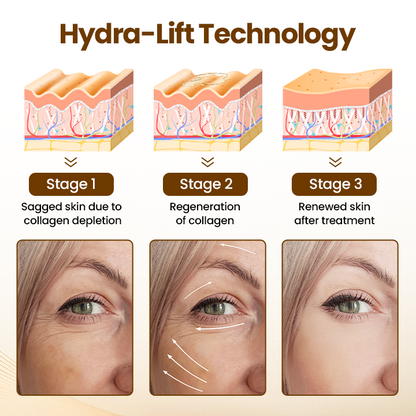 Biancat® Liftora 10s Wrinkle Serum