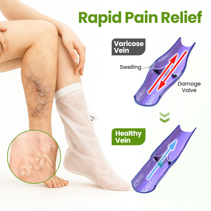 Timilk®VeinEase Leg Mask.