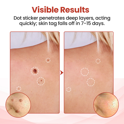 Biancat® TagDrop Painless Micro Patch.