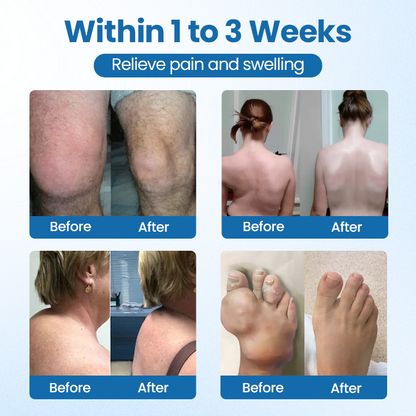 Timilk® BPC-157 Joint Repair Cream