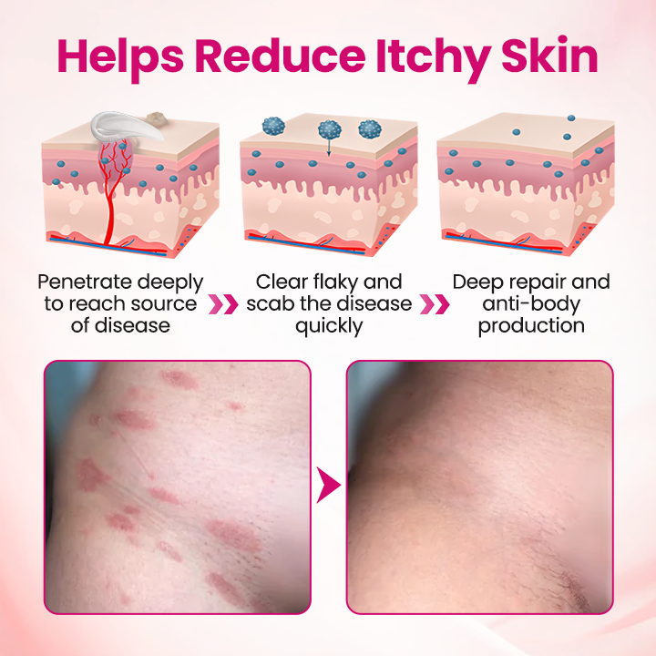 Timilk® IntiDefend Anti-HPV Interferon Gel.