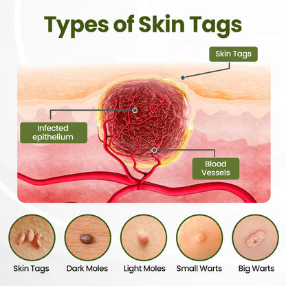 Biancat® MagneErase Renewal Cream