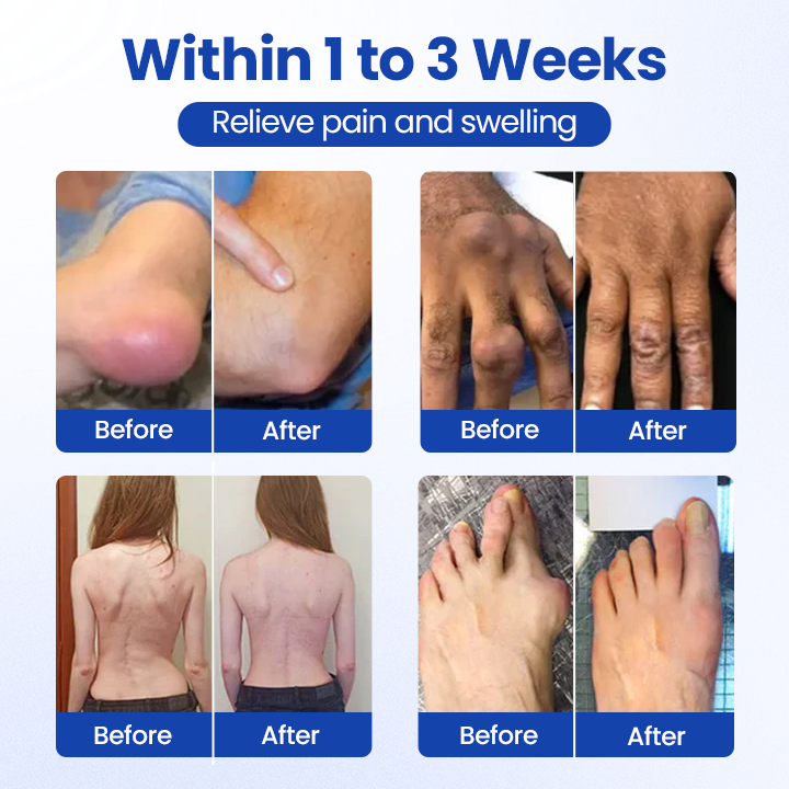 Timilk® BPC-157 Joint&Bone Repair Roll-On Gel