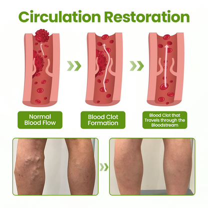 Timilk®VeinEase Leg Mask.