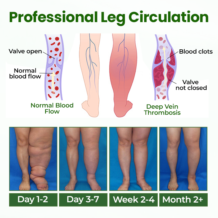 Timilk® BodyRelief Circulation Cream