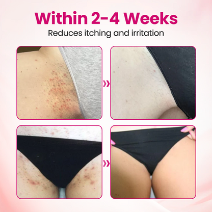 Timilk® IntiDefend Anti-HPV Interferon Gel.