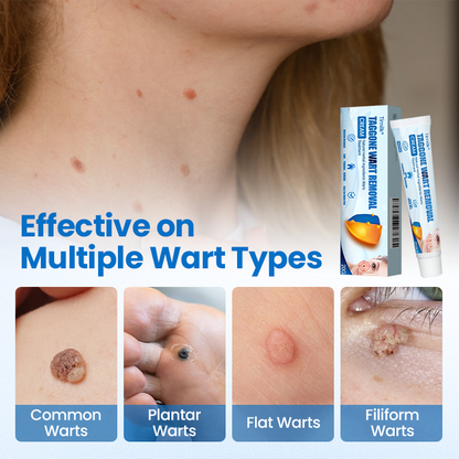 Timilk® TagGone Wart Removal Cream.